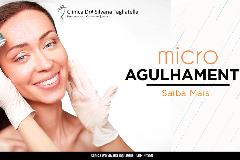 microagulhamento_face(final)